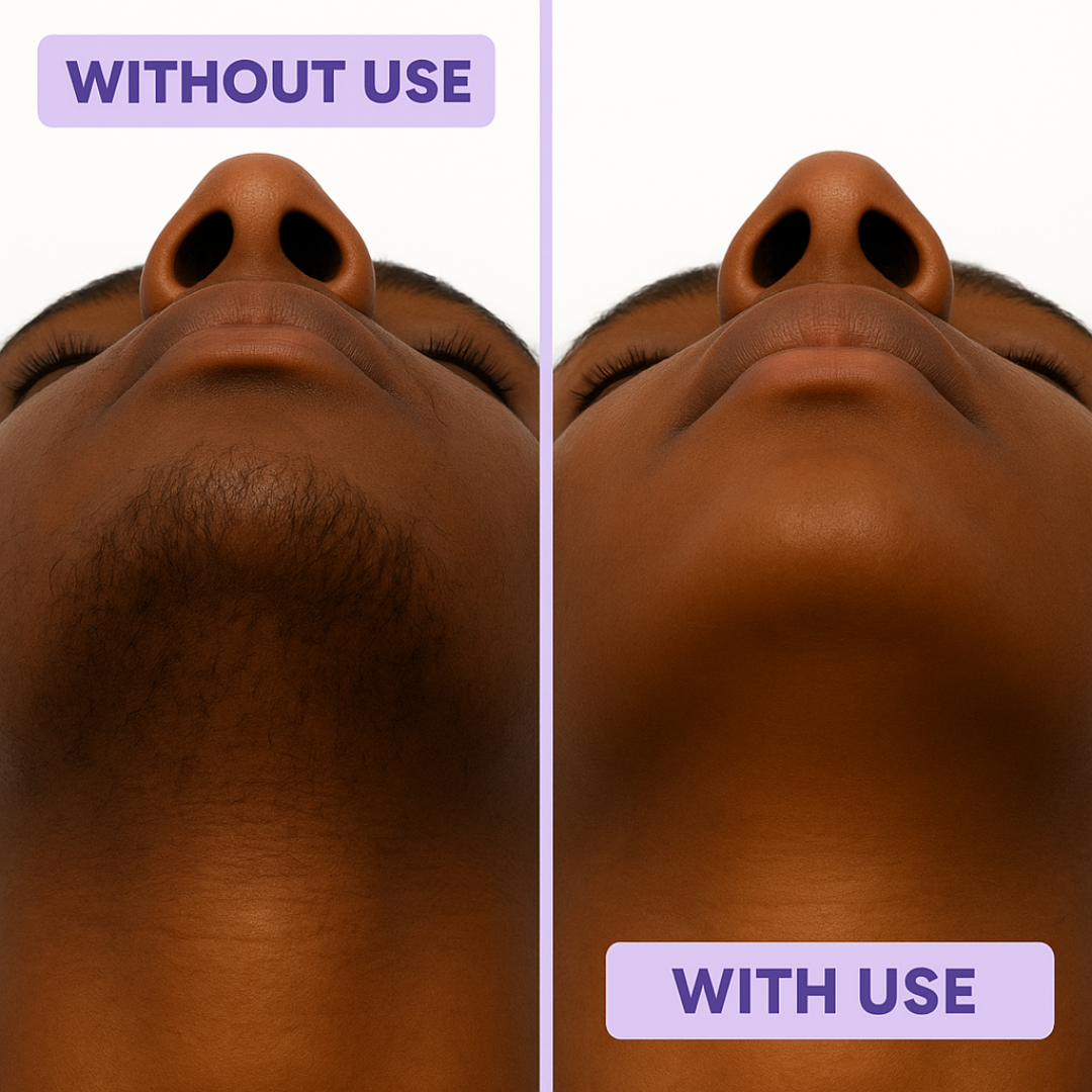 EpiLisse™ - Facial Hair Removal 2-Cream & 2-Serum Set